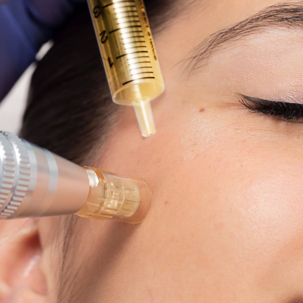 Natürlich jünger aussehen mit Botox Nürnberg